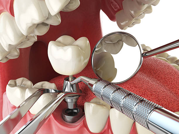 Best Cosmetic Emergency Dentistry in Woodworth, LA